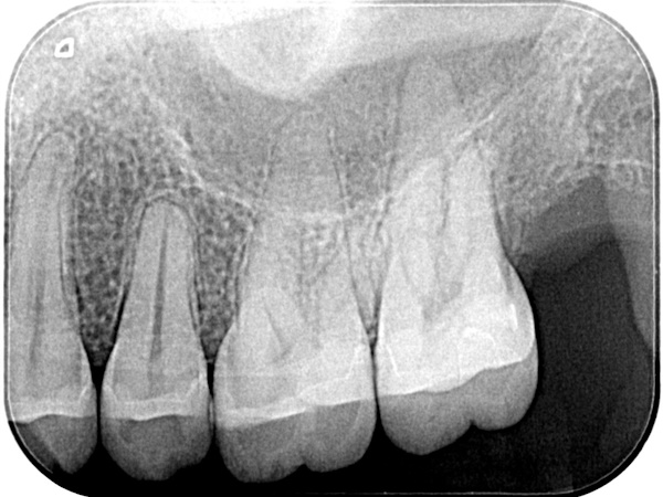Before image