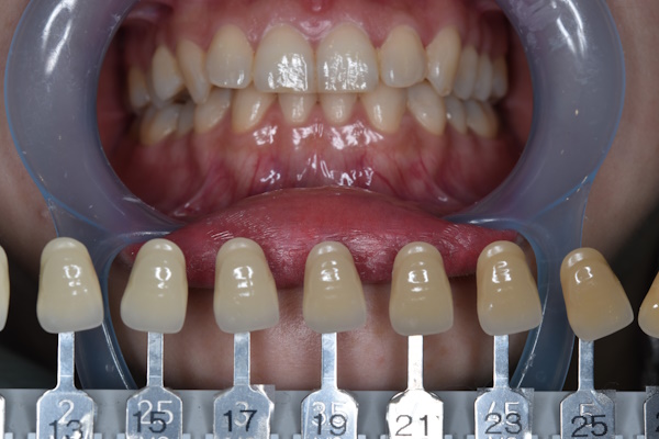 Before image