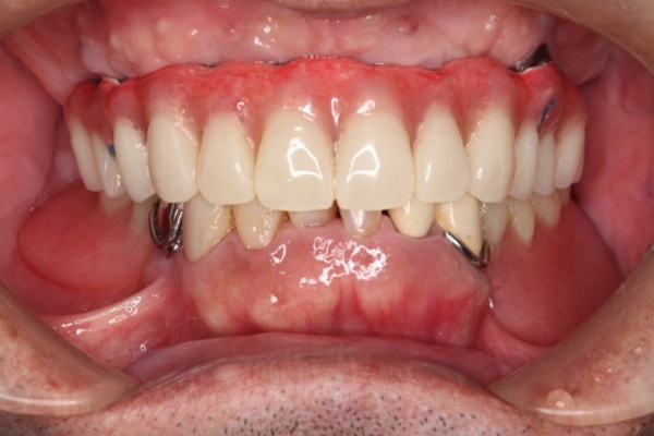After image