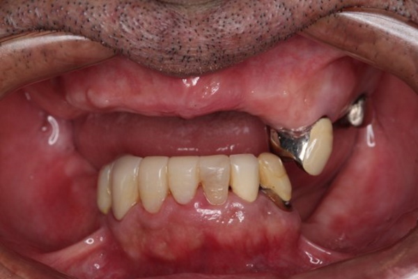 Before image