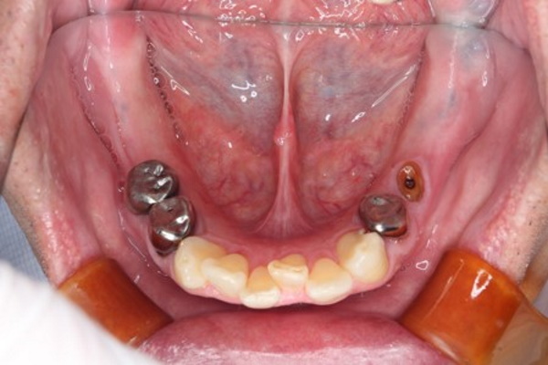 Before image