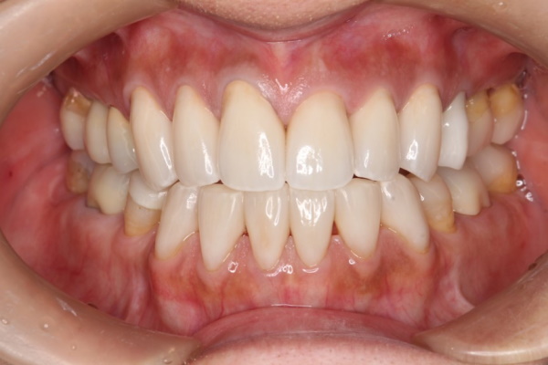 After image