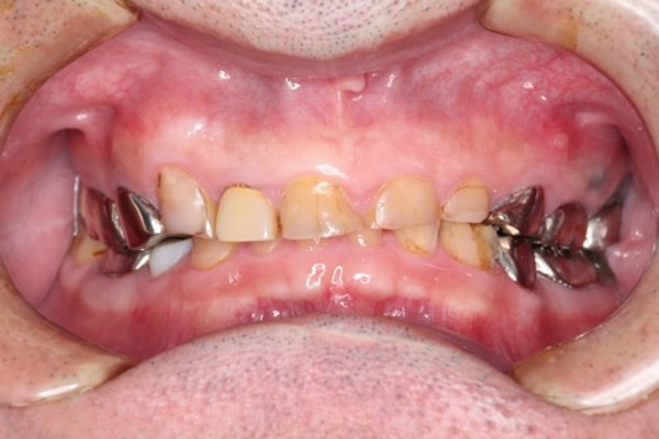 Before image