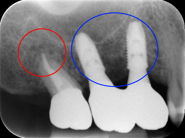 After image