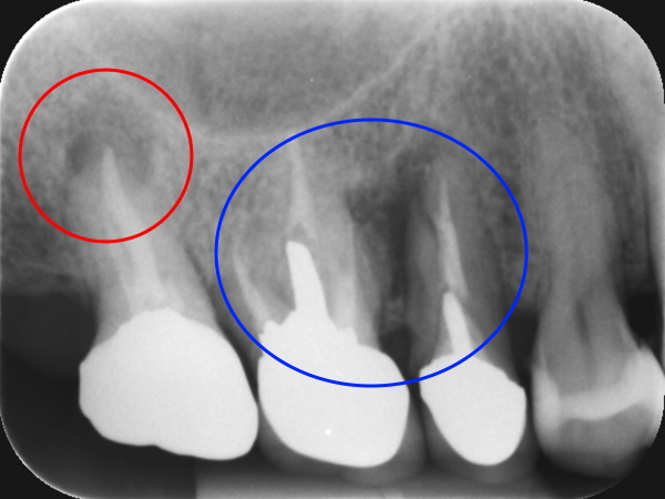 Before image