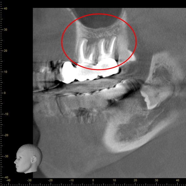 After image