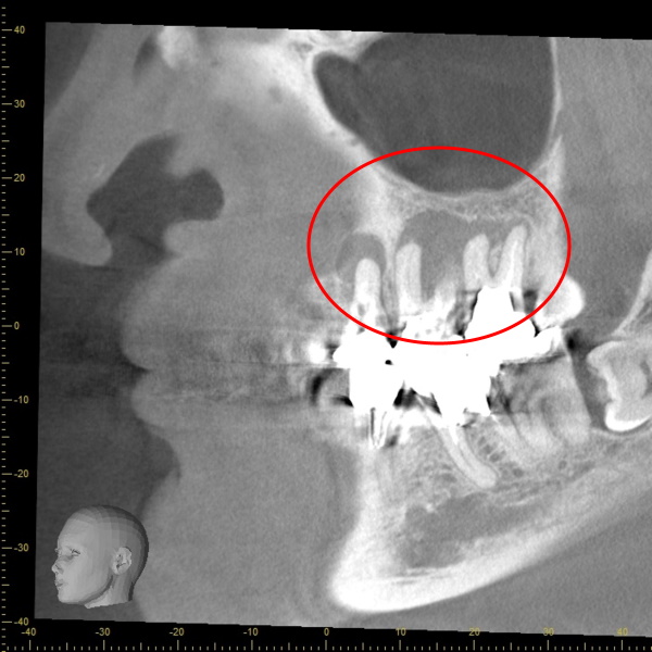 Before image