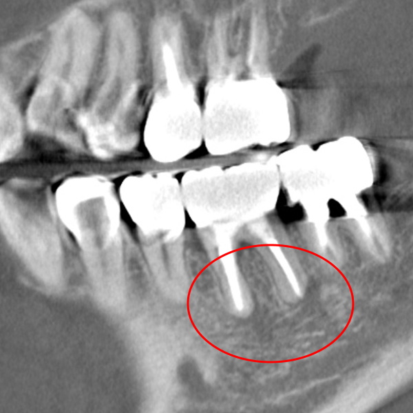After image