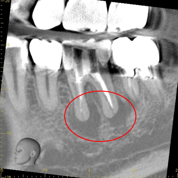 Before image