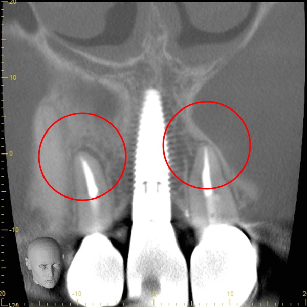After image