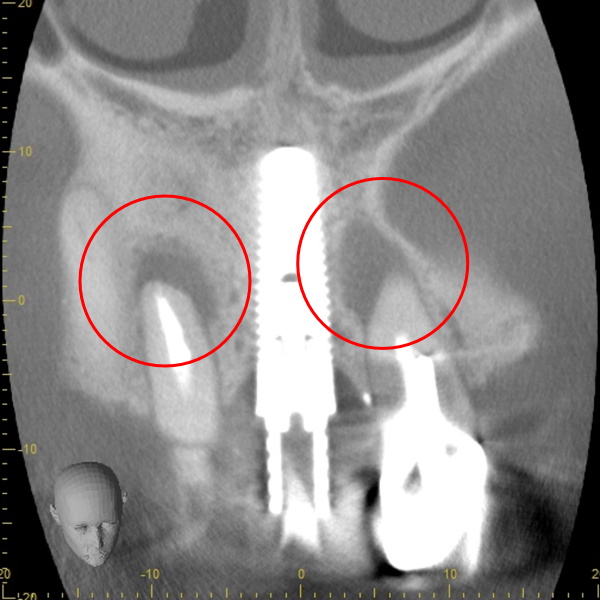 Before image