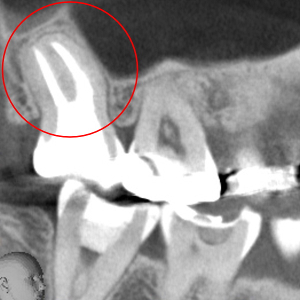 After image