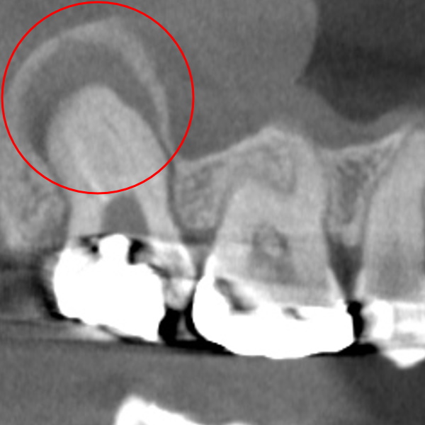 Before image