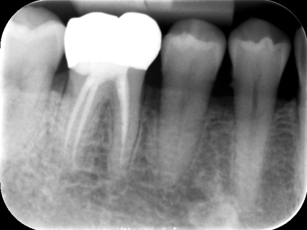 After image