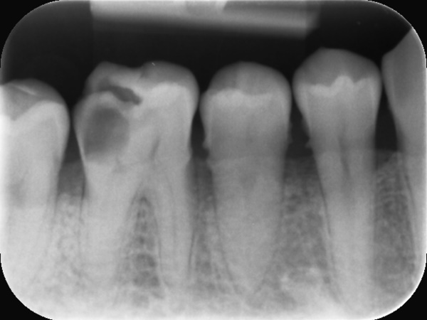 Before image