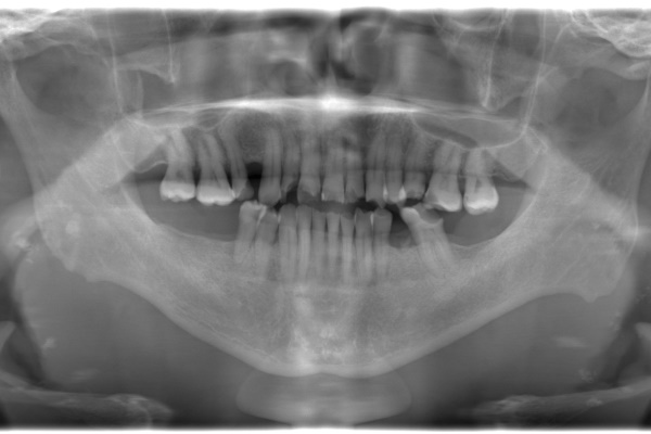 Before image