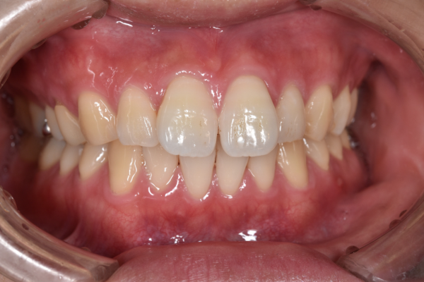 Before image