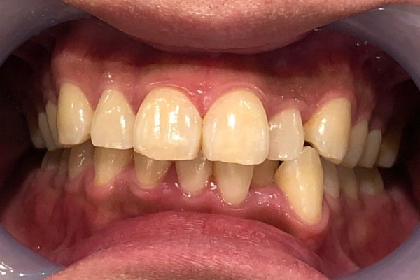 Before image
