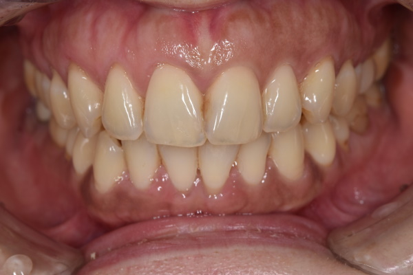 Before image