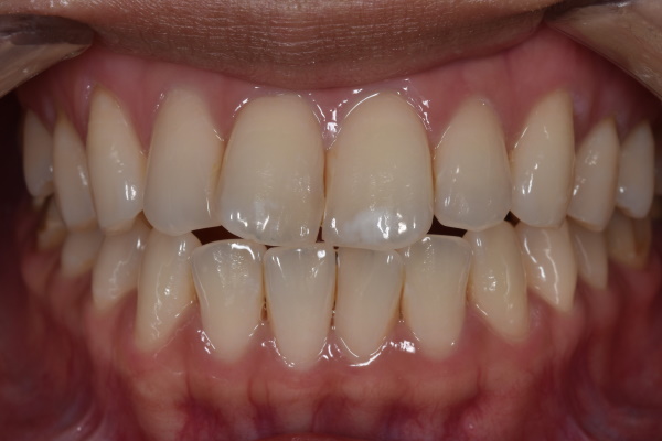 Before image