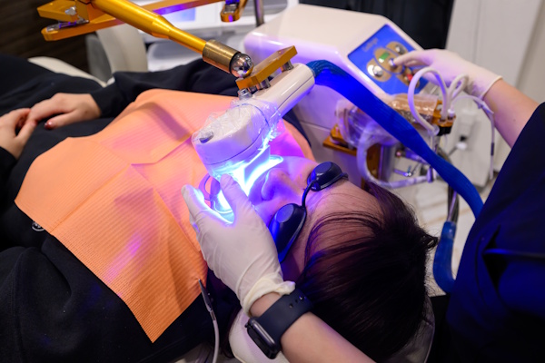 安全・無漂白剤ホワイトニング