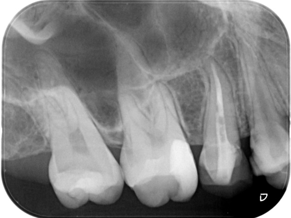 Before image