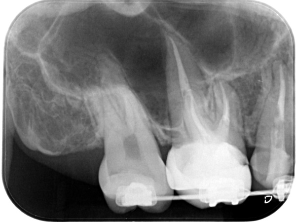 After image