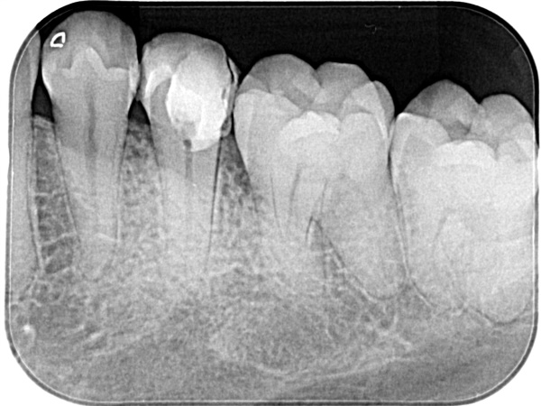 Before image