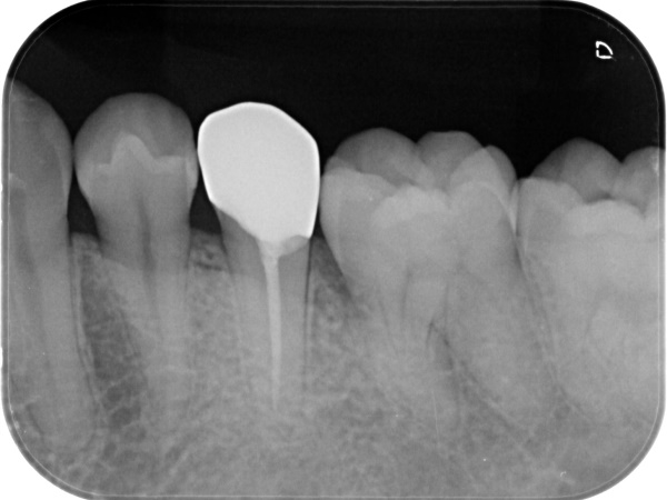 After image