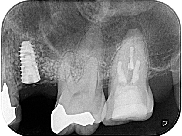 Before image