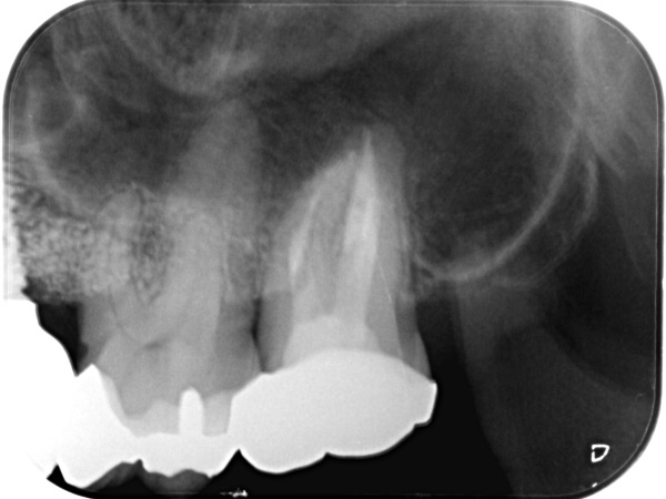 After image