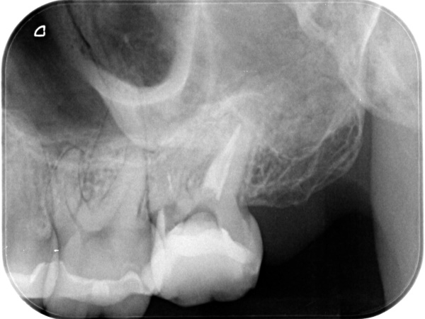 Before image