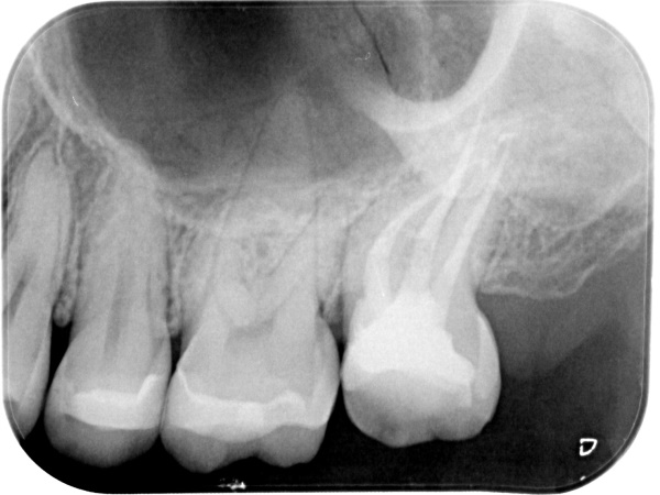 After image