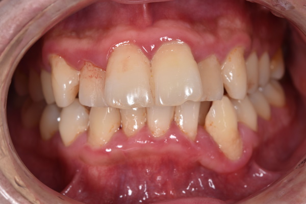 Before image