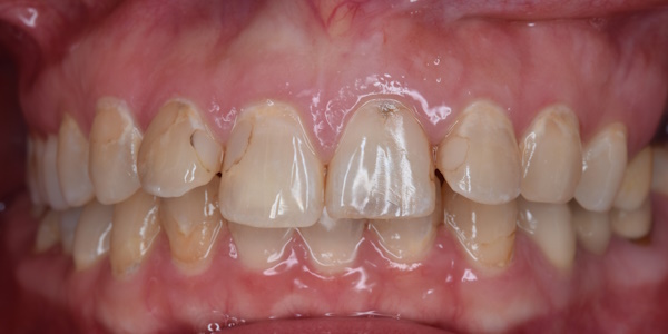 Before image