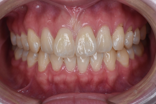 Before image