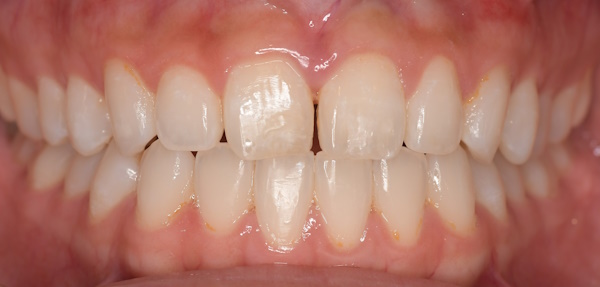 Before image