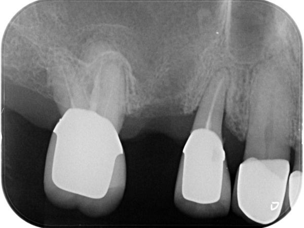 Before image