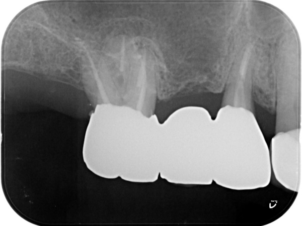 After image