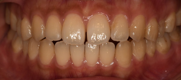 Before image