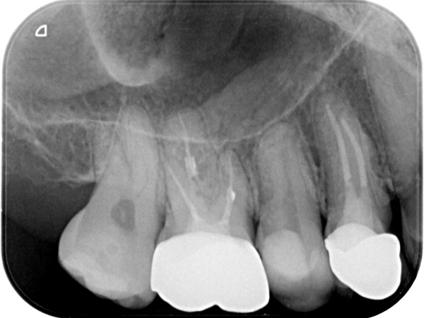 Before image