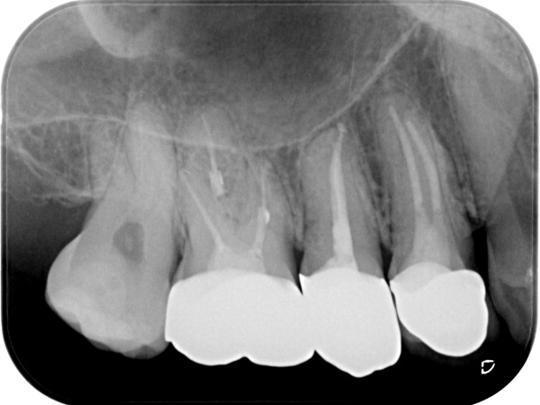 After image