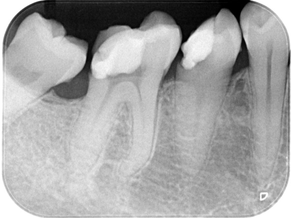 Before image