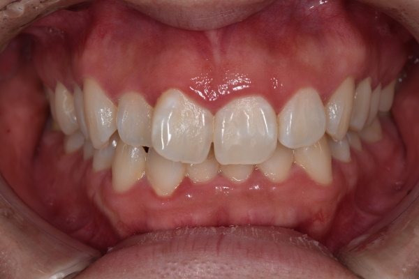 Before image