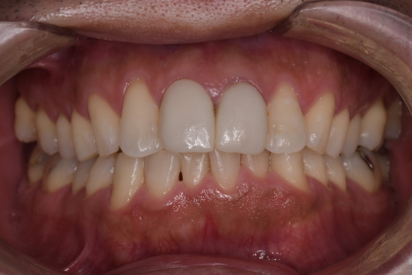 Before image