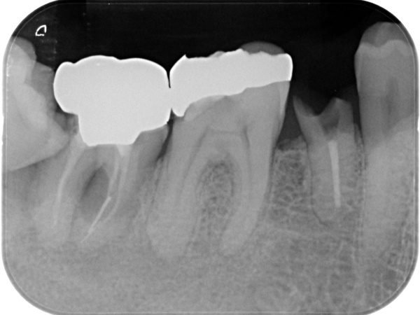 Before image