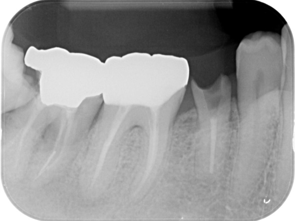 After image