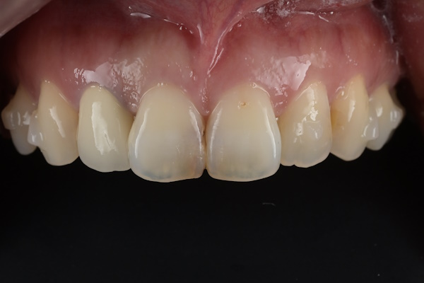Before image