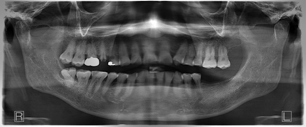 Before image