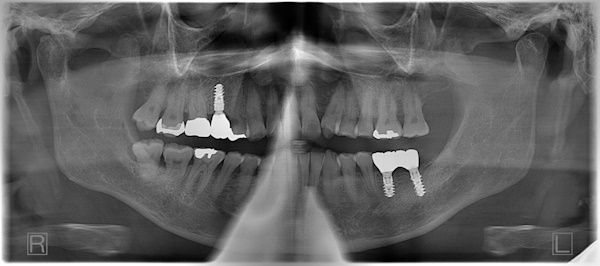 After image
